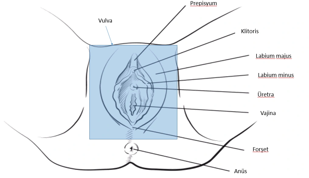 Vulva Kanseri